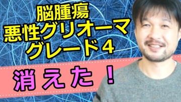 悪性グリオーマグレード４完治